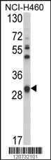 GSTO1 Antibody