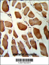 GSTO1 Antibody