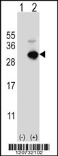 GSTO1 Antibody