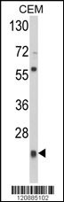 PRDX1 Antibody