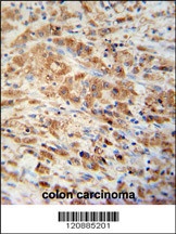 PRDX1 Antibody