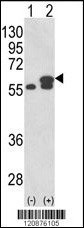 PDIA3 Antibody