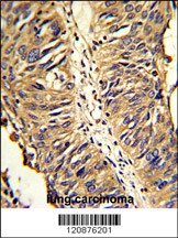 PDIA3 Antibody