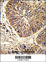 PDIA3 Antibody