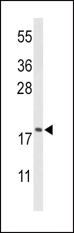 CFL1 Antibody