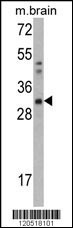 CAPZB Antibody