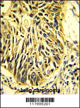 CD201 Antibody