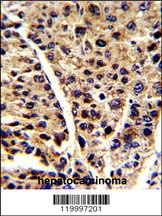 ENOB Antibody