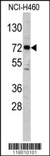 ELP2 Antibody