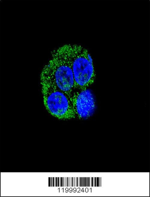 CD36 Antibody