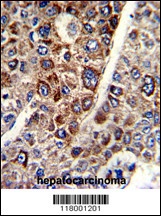 CD38 Antibody