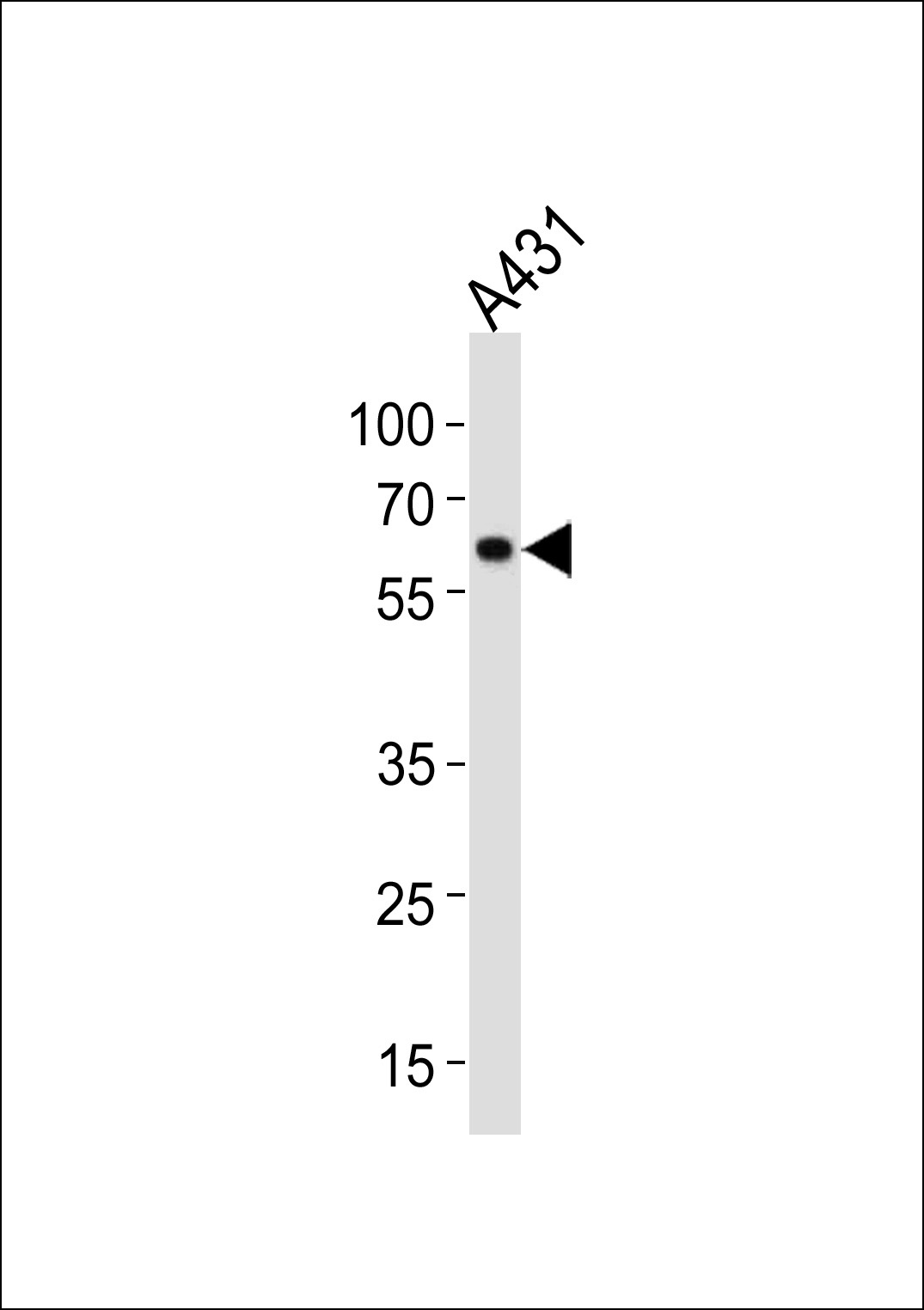HSPD1 Antibody