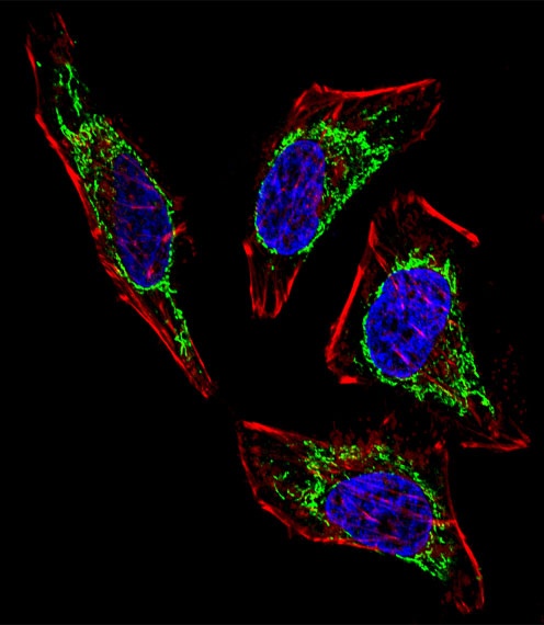 HSPD1 Antibody