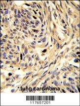 HSPD1 Antibody