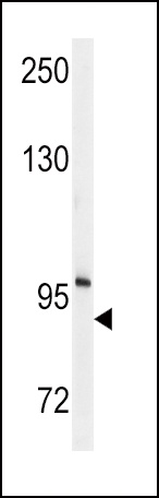 ENPP2 Antibody