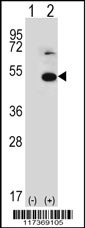 TRIP13 Antibody