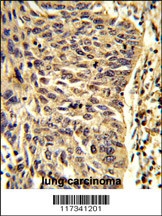 SNRPD1 Antibody