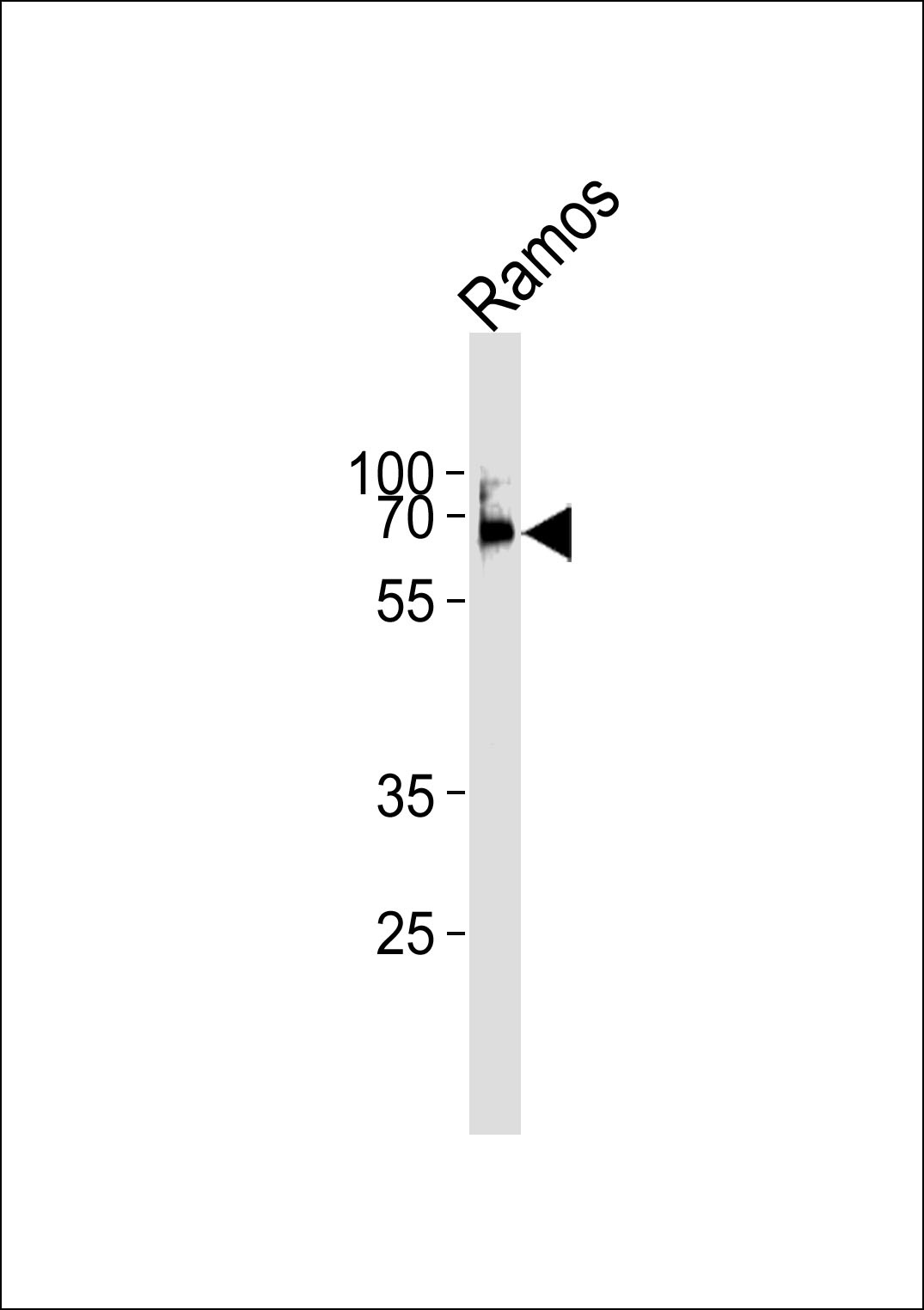 LCK Antibody