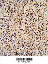 LCK Antibody