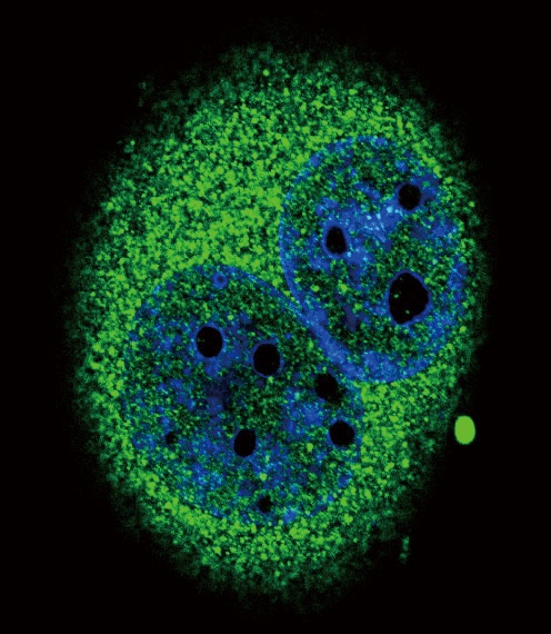 IRF5 Antibody