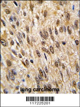 PTPN6 Antibody