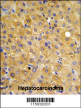 DLGAP5 Antibody