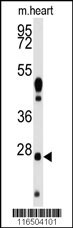 WDYHV1 Antibody