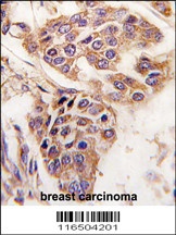 WDYHV1 Antibody