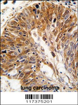 PSMD11 Antibody