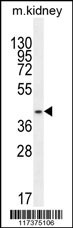 PSMD11 Antibody