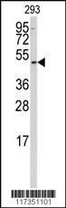 SSB Antibody