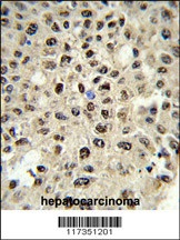 SSB Antibody
