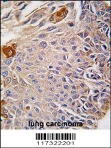 RMND5B Antibody