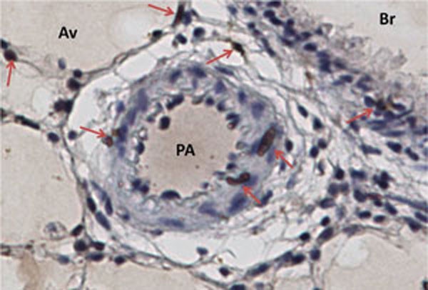 RFC2 Antibody