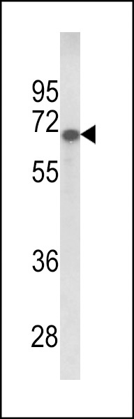 GPC4 Antibody