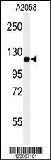 MCAM Antibody