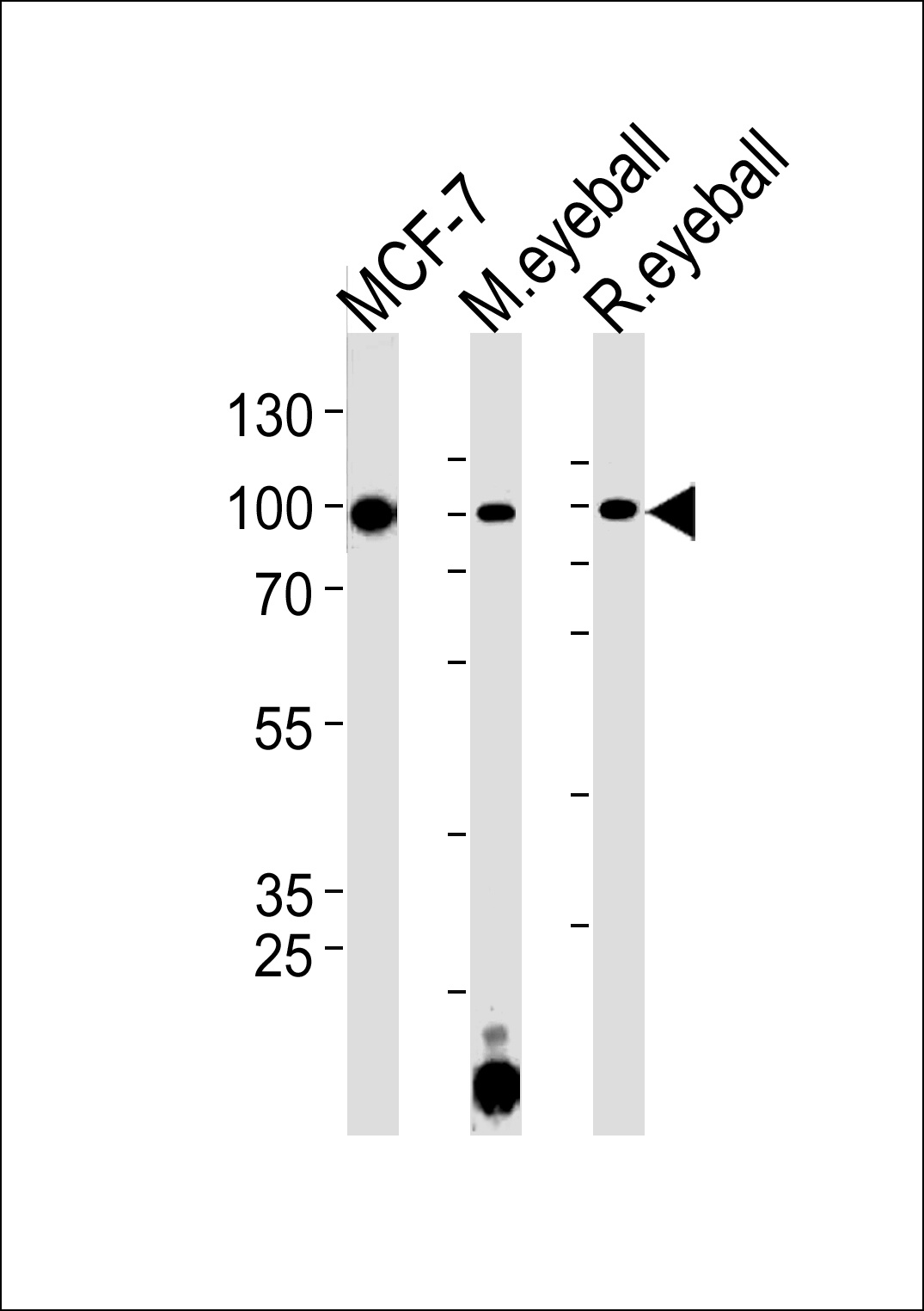 COL9A1 Antibody