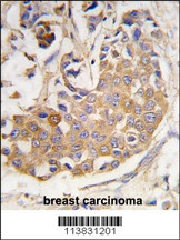 COL9A1 Antibody