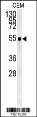 ZIC3 Antibody