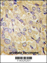 FZD1 Antibody