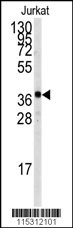 TAL1 Antibody