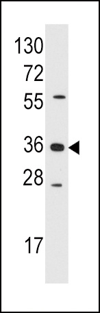 AKR1B1 Antibody