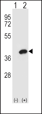 AKR1B1 Antibody