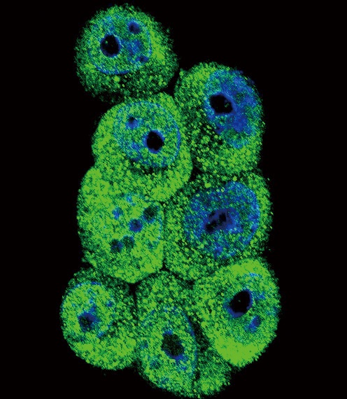 AKR1B1 Antibody