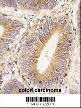 AKR1B1 Antibody