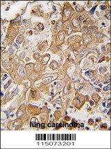 LECT1 Antibody