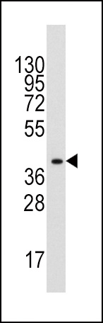 ALDOA Antibody