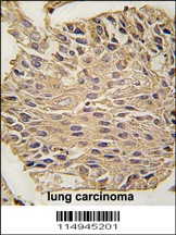 ALDOA Antibody