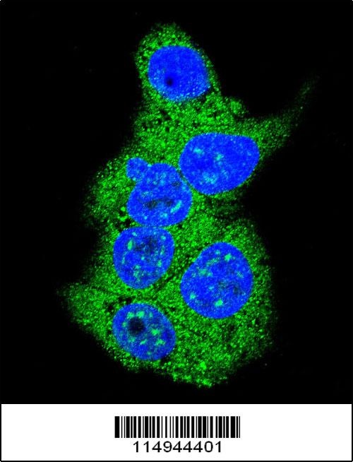 Aldolase Antibody