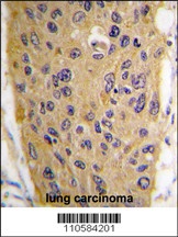 WIF1 Antibody